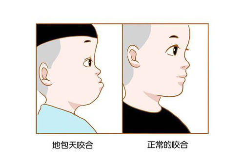 地包天