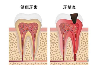 1-21120G50111410.jpg